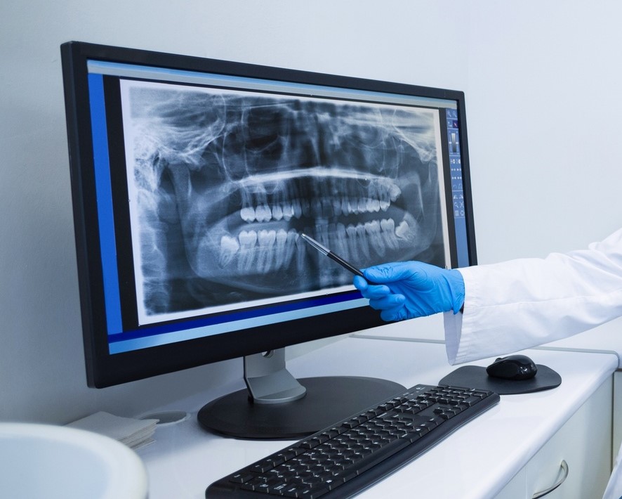 schermo diagnostica odontoiatrica